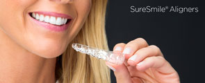SureSmile Aligners